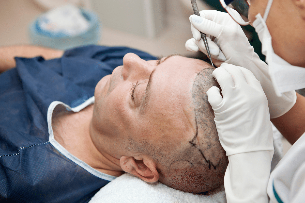 who performs hair restoration procedures