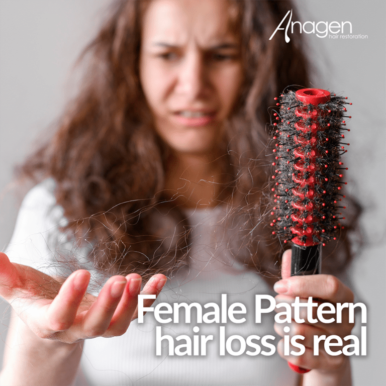Female Pattern hair loss is real