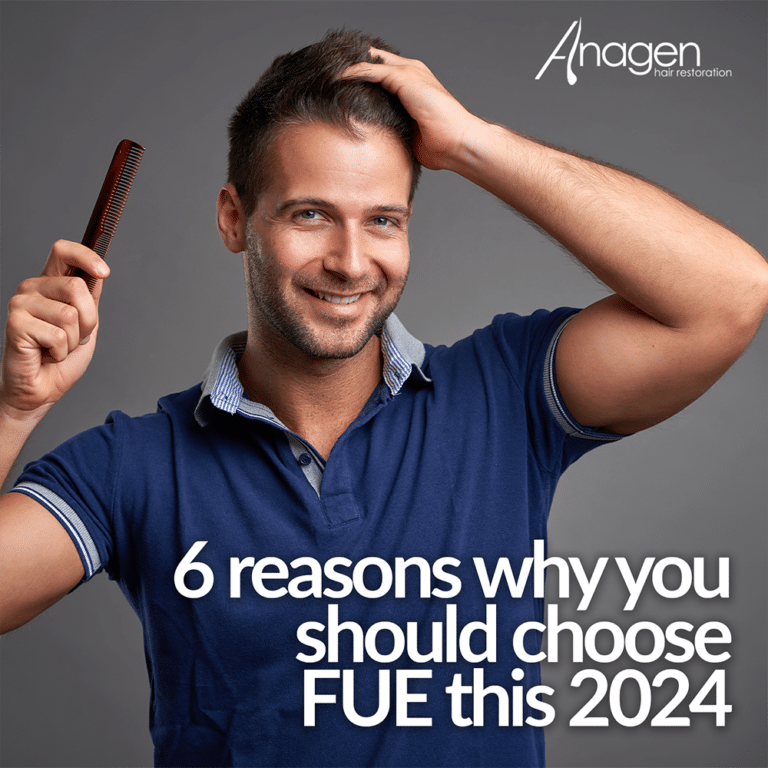 6 reasons why you should choose FUE this 2024