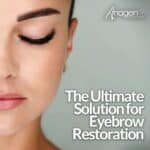 The Ultimate Solution for Eyebrow Restoration