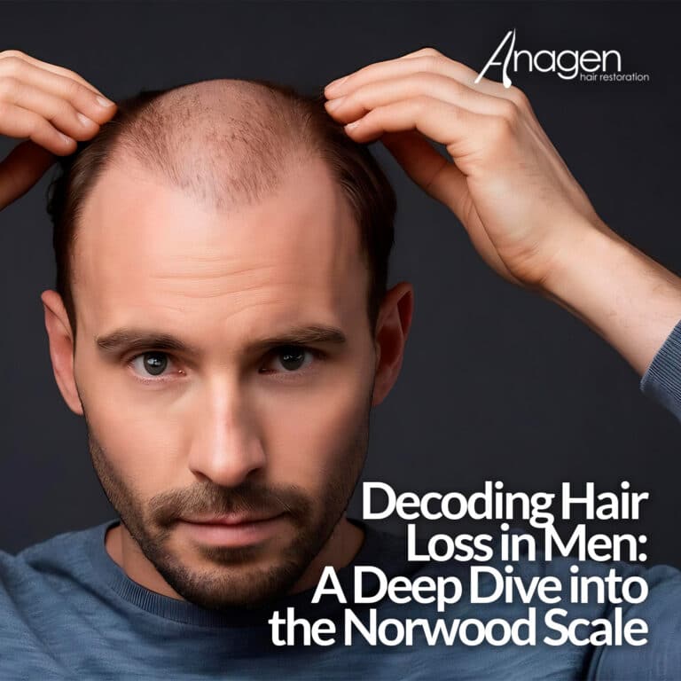 Decoding Hair Loss in Men: A Deep Dive into the Norwood